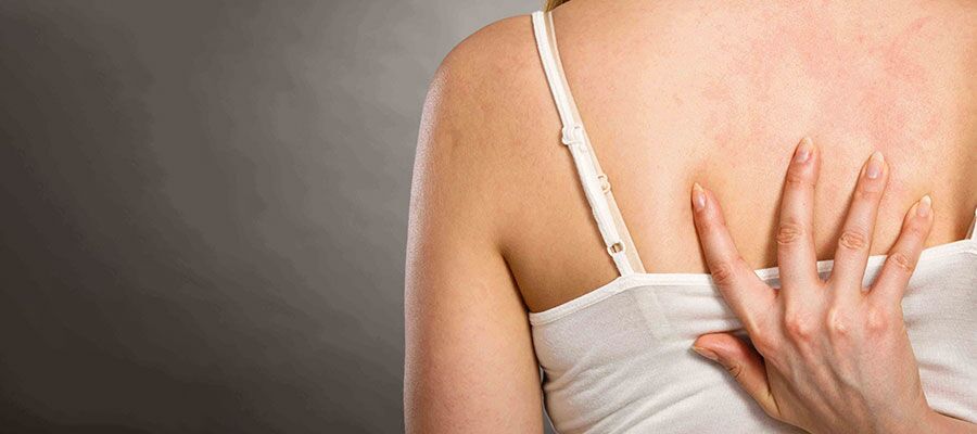 Quelles sont les causes des allergies cutanes ? - Aktif International  HospitalAktif International Hospital